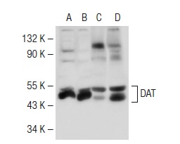 DAT (H-80): sc-14002. Western blot analysis of DAT expression in SH-SY5Y (A) and SK-N-SH (B) whole cell lysates and mouse kidney (C) and mouse brain (D) tissue extracts.
