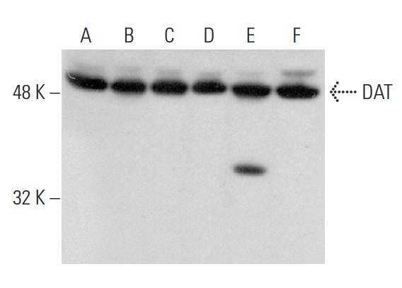 DAT (H-80): sc-14002. Western blot analysis of DAT expression in BE (2)-M17 (A), IMR-32 (B), SK-N-SH (C), SH-SY5Y (D), SK-N-MC (E) and EOC 20 (F) whole cell lysates.