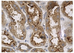DAT (H-80): sc-14002. Immunoperoxidase staining of formalin fixed, paraffin-embedded human kidney tissue showing membrane and cytoplasmic staining of cells in tubules.