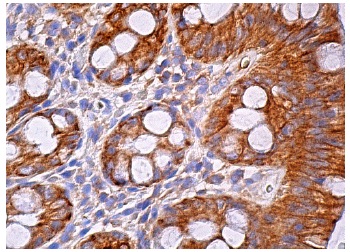 SPA-1 (C-1): sc-137043. Immunoperoxidase staining of formalin fixed, paraffin-embedded human rectum tissue showing membrane and cytoplasmic staining of glandular cells.