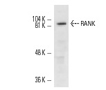 RANK (H-300): sc-9072. Western blot analysis of RANK expression in Hep G2 whole cell lysate.