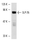 SLP-76 (H-300): sc-9062. Western blot analysis of SLP-76 expression in AML 193 whole cell lysate.