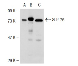 SLP-76 (H-300): sc-9062. Western blot analysis of SLP-76 expression in non-transfected 293T: sc-117752 (A), mouse SLP-76 transfected 293T: sc-126013 (B) and BJAB (C) whole cell lysates.