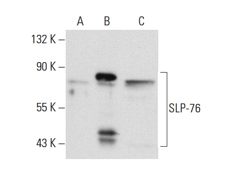 SLP-76 (H-300): sc-9062. Western blot analysis of SLP-76 expression in non-transfected 293T: sc-117752 (A), human SLP-76 transfected 293T: sc-175892 (B) and AML-193 (C) whole cell lysates.