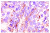 TM (H-300): sc-9162. Immunoperoxidase staining of formalin-fixed, paraffin-embedded human tonsil tissue showing membrane staining.