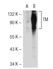 TM (H-300): sc-9162. Western blot analysis of TM expression in non-transfected: sc-117752 (A) and human TM transfected: sc-115666 (B) 293T whole cell lysates.