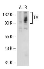 TM (H-300): sc-9162. Western blot analysis of TM expression in non-transfected: sc-117752 (A) and mouse TM transfected: sc-127663 (B) 293T whole cell lysates.