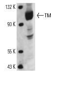 TM (D-3): sc-13164. Western blot analysis of TM expression in CCRF-CEM whole cell lysate.