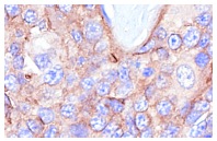 TM (D-3): sc-13164. Immunoperoxidase staining of formalin-fixed, paraffin-embedded human tonsil tissue showing membrane staining.