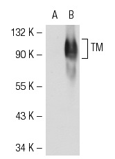 TM (D-3): sc-13164. Western blot analysis of TM expression in non-transfected: sc-117752 (A) and human TM transfected: sc-115666 (B) 293T whole cell lysates.
