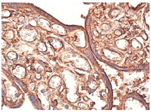 TM (D-3): sc-13164. Immunoperoxidase staining of formalin fixed, paraffin-embedded human placenta tissue showing cytoplasmic and membrane staining of trophoblastic cells.