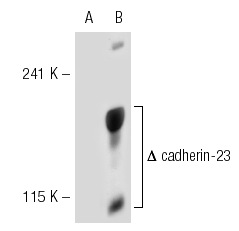 cadherin-23 (H-300): sc-32864. Western blot analysis of cadherin-23 expression in non-transfected: sc-117752 (A) and truncated human cadherin-23 transfected: sc-115145 (B) 293T whole cell lysates.