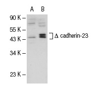 cadherin-23 (H-300): sc-32864. Western blot analysis of cadherin-23 expression in non-transfected: sc-117752 (A) and truncated human cadherin-23 transfected: sc-112533 (B) 293T whole cell lysates.