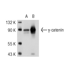 γ-catenin (C-20)-R: sc-1497-R. Western blot analysis of γ-catenin expression in non-transfected: sc-117752 (A) and mouse γ-catenin transfected: sc-125099 (B) 293T whole cell lysates.