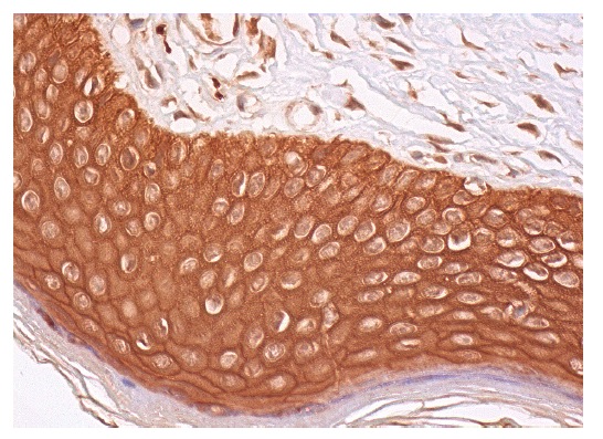 γ-catenin (C-20)-R: sc-1497-R. Immunoperoxidase staining of formalin fixed, paraffin-embedded human vulva/anal skin tissue showing cytoplasmic and membrane staining of epidermal cells.
