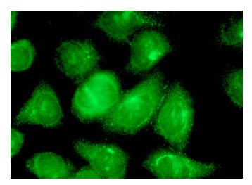 γ-catenin (H-1): sc-8415. Immunofluorescence staining of methanol-fixed HeLa cells showing membrane and cell junction localization.