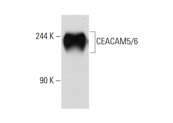 CEACAM5/6 (By114): sc-20059. Western blot analysis of CEACAM5/6 expression in MCF7 whole cell lysate.