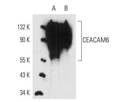CEACAM6 (9A6): sc-59899. Western blot analysis of CEACAM6 expression in human PBL (A) and LS1034 (B) whole cell lysates.