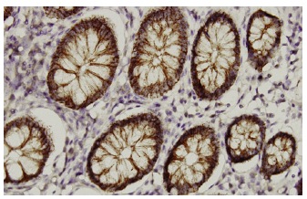 claudin-1 (XX7): sc-81796. Immunoperoxidase staining of formalin-fixed, paraffin-embedded human stomach tissue showing membrane and cytoplasmic localization.