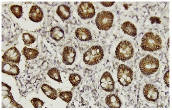 claudin-1 (XX7): sc-81796. Immunoperoxidase staining of formalin-fixed, paraffin-embedded human stomach tissue showing membrane and cytoplasmic localization.