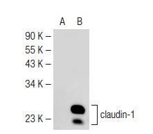 claudin-1 (XX7): sc-81796. Western blot analysis of claudin-1 expression in non-transfected: sc-117752 (A) and human claudin-1 transfected: sc-176724 (B) 293T whole cell lysates.