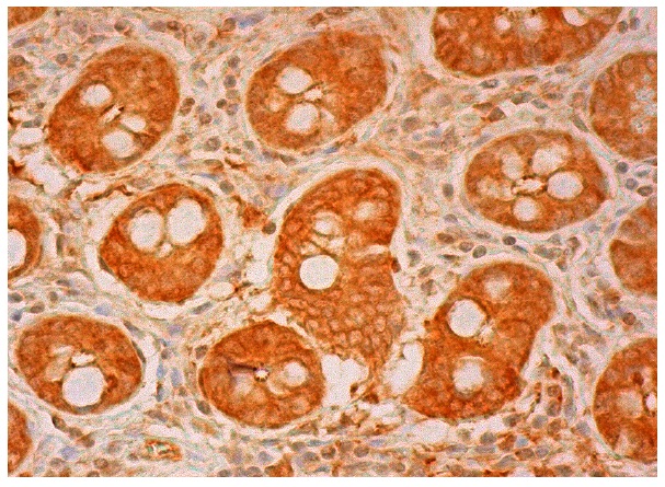 CLP36 (B-9): sc-393084. Immunoperoxidase staining of formalin fixed, paraffin-embedded human colon tissue showing cytoplasmic staining of glandular cells and endothelial cells.
