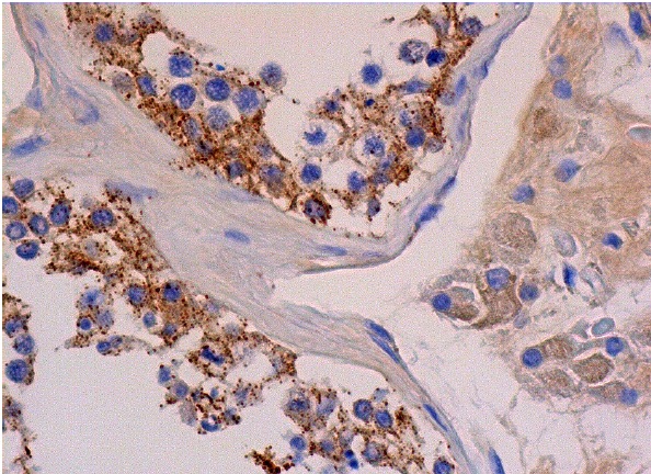 CLP36 (H-11): sc-374077. Immunoperoxidase staining of formalin fixed, paraffin-embedded human testis tissue showing cytoplasmic staining of cells in seminiferous ducts and Leydig cells.