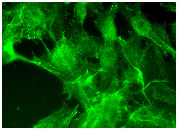 CLP36 (H-11): sc-374077. Immunofluorescence staining of formalin-fixed HepG2 cells showing cytoskeletal localization.