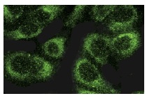 COL18A1 (H-140): sc-25720. Immunofluorescence staining of methanol-fixed A549 cells showing cytoplasmic localization.