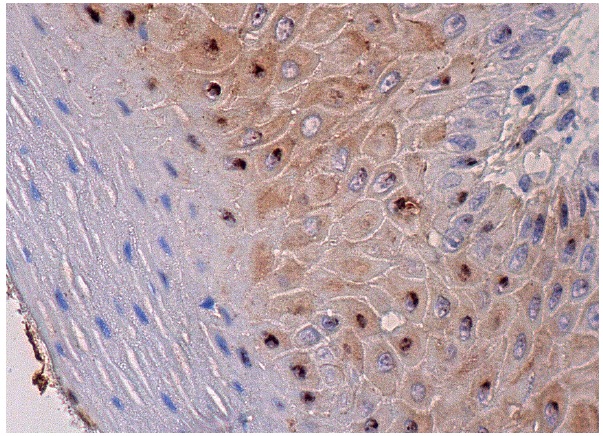 COL18A1 (H-140): sc-25720. Immunoperoxidase staining of formalin fixed, paraffin-embedded human oral mucosa tissue showing cytoplasmic and nuclear staining of squamous epithelial cells.