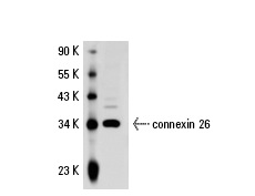 connexin 26 (N-19)-R: sc-7261-R. Western blot analysis of connexin 26 expression in Hep G2 whole cell lysate.