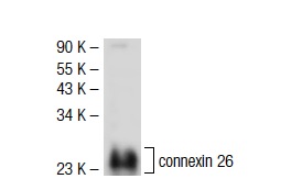 connexin 26 (N-19)-R: sc-7261-R. Western blot analysis ofconnexin 26 expression in mouse liver tissue extract.