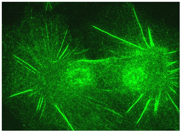 connexin 26 (N-19): sc-7261. Immunofluorescence staining of formalin-fixed HepG2 cells showing membrane localization.