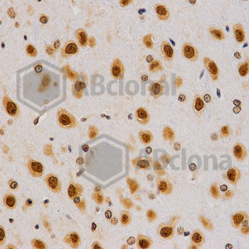 Immunohistochemistry of paraffin-embedded rat brain tissue using H4R3me2a antibody at dilution of 1:200 (x40 lens)