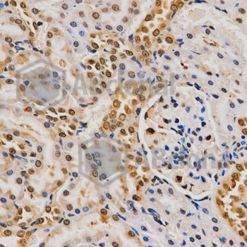 Immunohistochemistry of paraffin-embedded rat kidney tissue using H4R3me2a antibody at dilution of 1:200 (x40 lens)