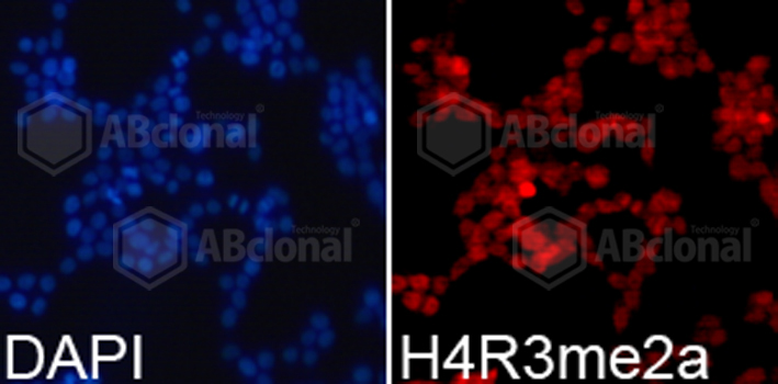 Immunofluorescence analysis of 293T cell using H4R3me2a antibody. Blue: DAPI for nuclear staining.