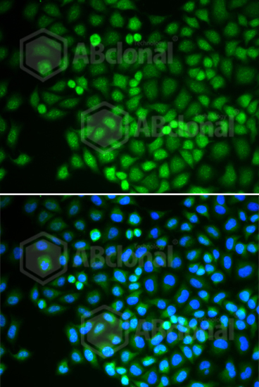 Immunofluorescence analysis of U2OS cell using POLR2D antibody. Blue: DAPI for nuclear staining.