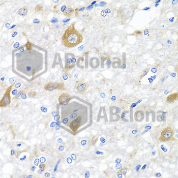 Immunohistochemistry of paraffin-embedded rat brain using NRG4 antibody at dilution of 1:100 (40x lens).