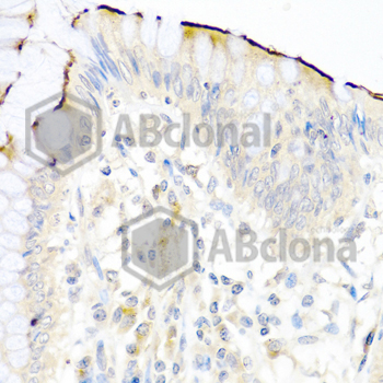 Immunohistochemistry of paraffin-embedded human colon using NRG4 antibody at dilution of 1:100 (40x lens).