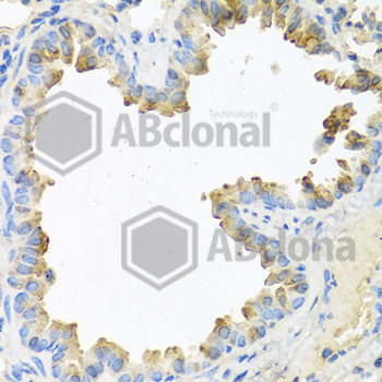 Immunohistochemistry of paraffin-embedded mouse lung using NRG4 antibody at dilution of 1:100 (40x lens).