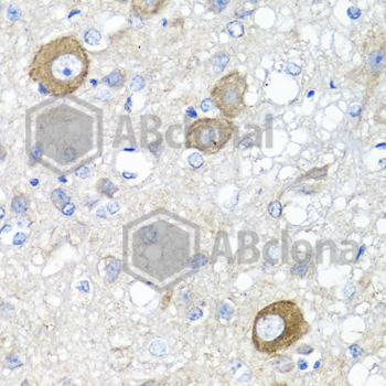 Immunohistochemistry of paraffin-embedded rat brain using NRG4 antibody at dilution of 1:100 (40x lens).