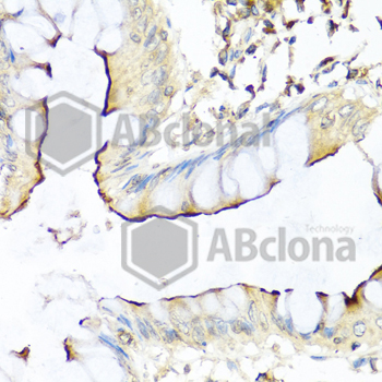 Immunohistochemistry of paraffin-embedded human colon using NRG4 antibody at dilution of 1:100 (40x lens).