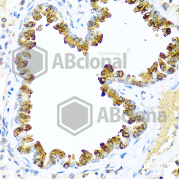 Immunohistochemistry of paraffin-embedded mouse lung using NRG4 antibody at dilution of 1:100 (40x lens).