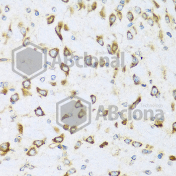 Immunohistochemistry of paraffin-embedded mouse brain using NRG4 antibody at dilution of 1:100 (40x lens).