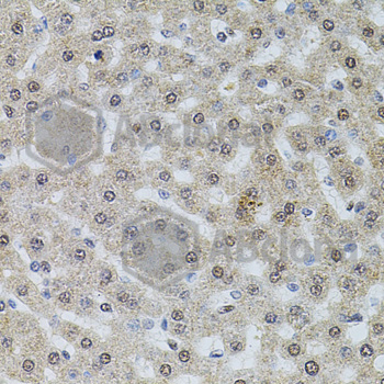Immunohistochemistry of paraffin-embedded rat liver tissue using POP4 antibody at dilution of 1:100 (x40 lens).