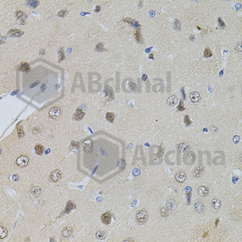Immunohistochemistry of paraffin-embedded rat brain tissue using POP4 antibody at dilution of 1:100 (x40 lens).