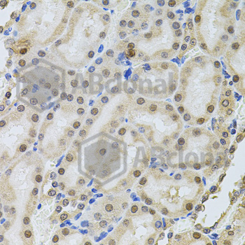 Immunohistochemistry of paraffin-embedded rat kidney tissue using POP4 antibody at dilution of 1:100 (x40 lens).