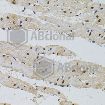 Immunohistochemistry of paraffin-embedded rat heart tissue using POP4 antibody at dilution of 1:100 (x40 lens).