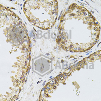 Immunohistochemistry of paraffin-embedded human prostate tissue using POP4 antibody at dilution of 1:100 (x40 lens).