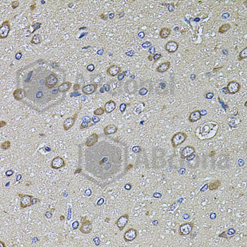 Immunohistochemistry of paraffin-embedded rat brain tissue using PTCD3 antibody at dilution of 1:100 (x40 lens).